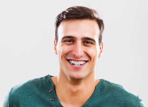 Jak radzić sobie z osadem i przebarwieniami podczas leczenia ortodontycznego?